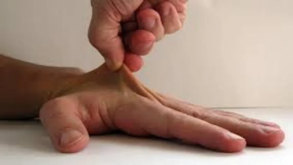 A Comprehensive Framework for Understanding Joint Hypermobility and Ehlers-Danlos Syndrome Symptoms Across Clinical Presentations