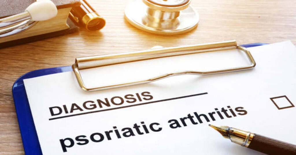 Psoriatic Arthritis