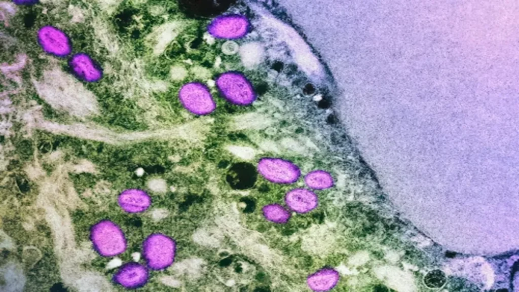 Peyronie’s Disease