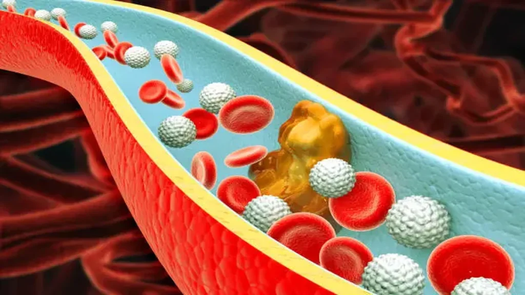 Fiebrigen Explained: Understanding Fibrinogen and Blood Clotting Health