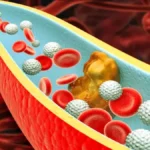 Fiebrigen Explained: Understanding Fibrinogen and Blood Clotting Health